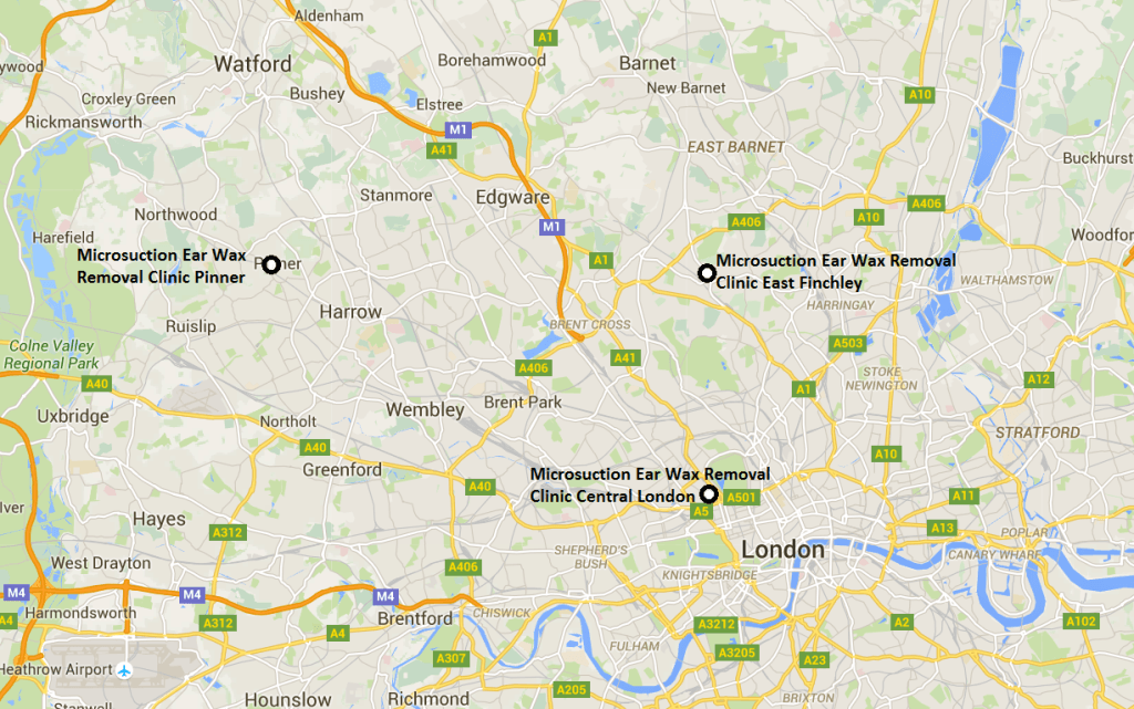 Microsuction in London NW1, N2, NW7, NW11, W13, HA5 and IG10 From £50
